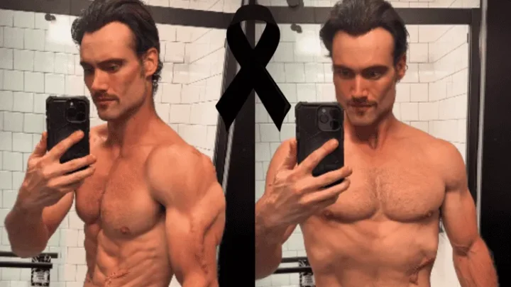 Influencer fallece tras brote psicótico: se inyectaba oro líquido para obtener “superpoderes”