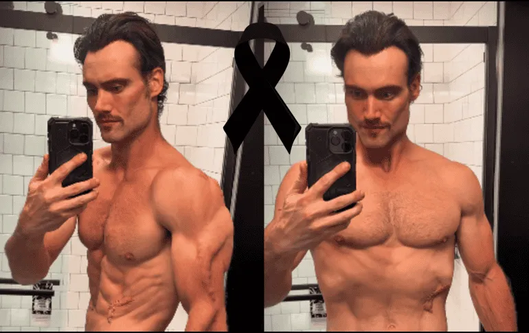 Influencer fallece tras brote psicótico: se inyectaba oro líquido para obtener “superpoderes”